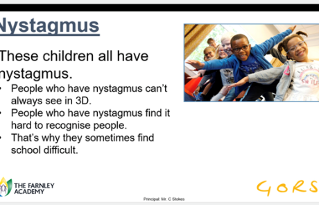 Nystagmus